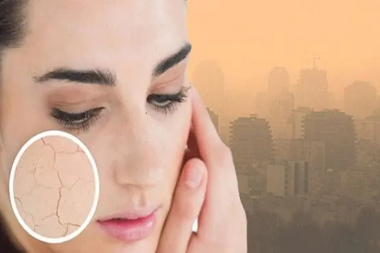 آلودگی هوا چطور به پوست آسیب می رساند؟
